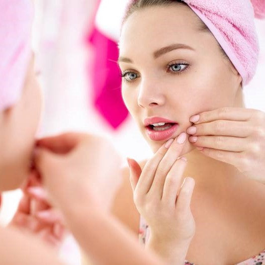 Jak se zbavit akné?
