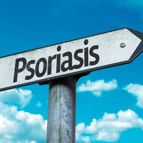 Jak se zbavit lupenky?